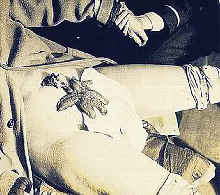 Mina Crandon - Ectoplasmic spirit-hand materialised from Solar Plexus