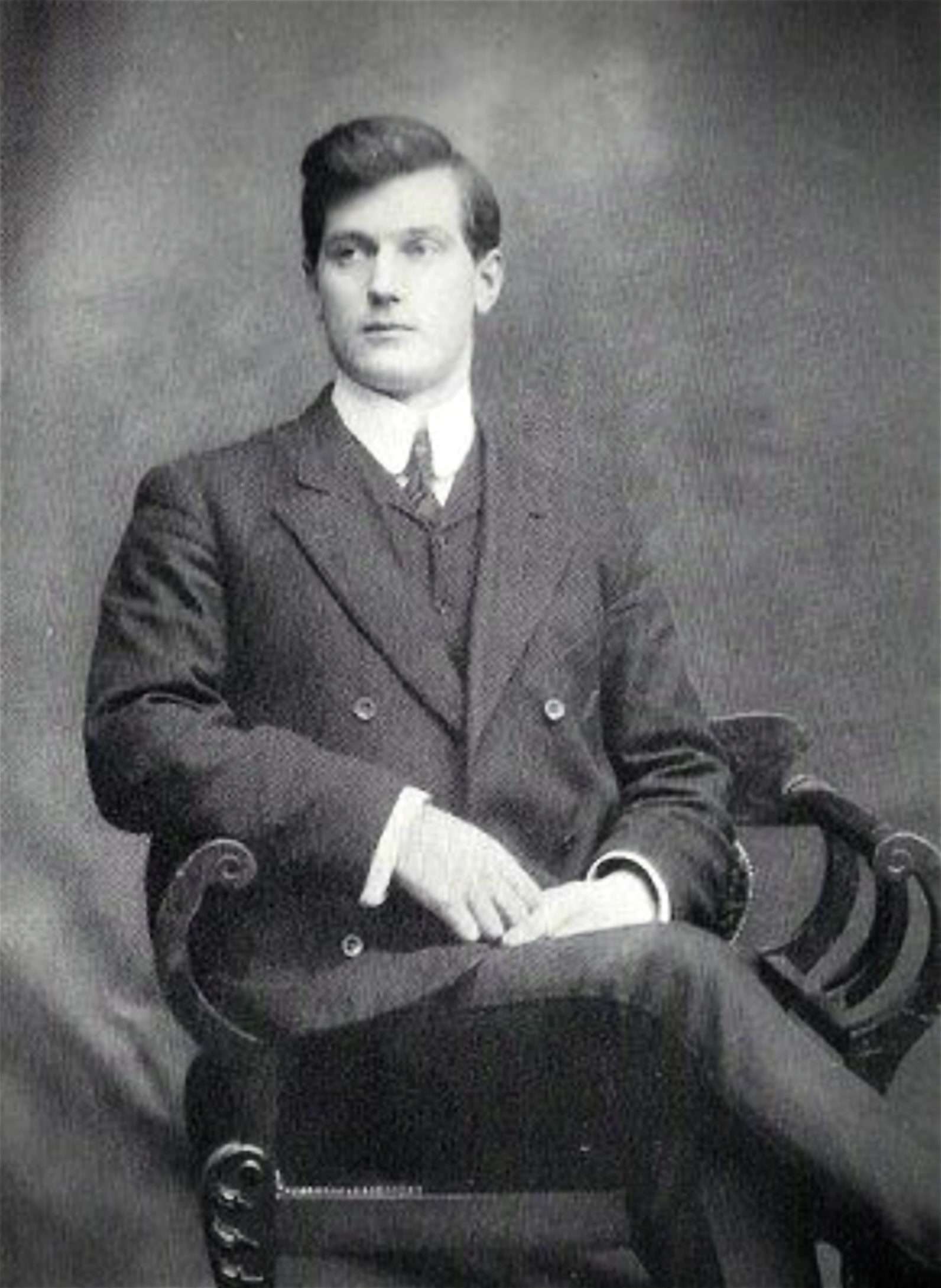 Walter Stinson - Ectoplasmic spirit-hand materialised from Solar Plexus of Mina Crandon purports to be her brother Walter Stinson